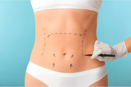 Body Contouring