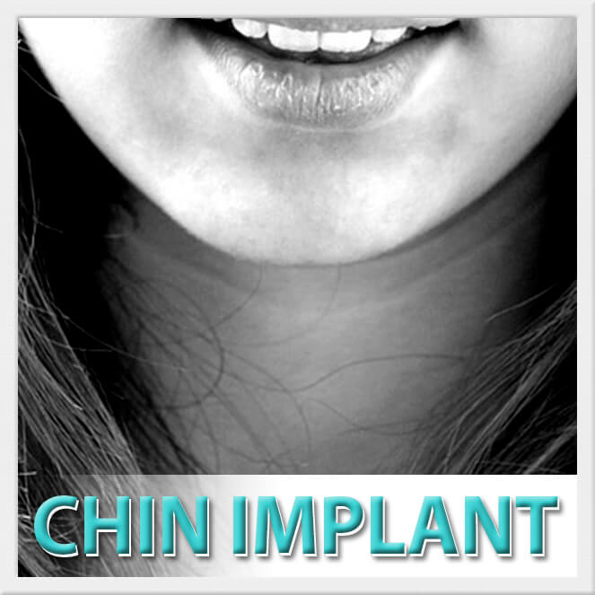 mexico cosmetic center, chin implant surgery