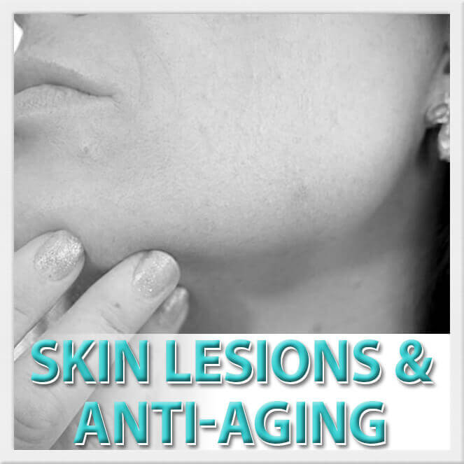 mexico cosmetic center, skin lesions and anti-aging