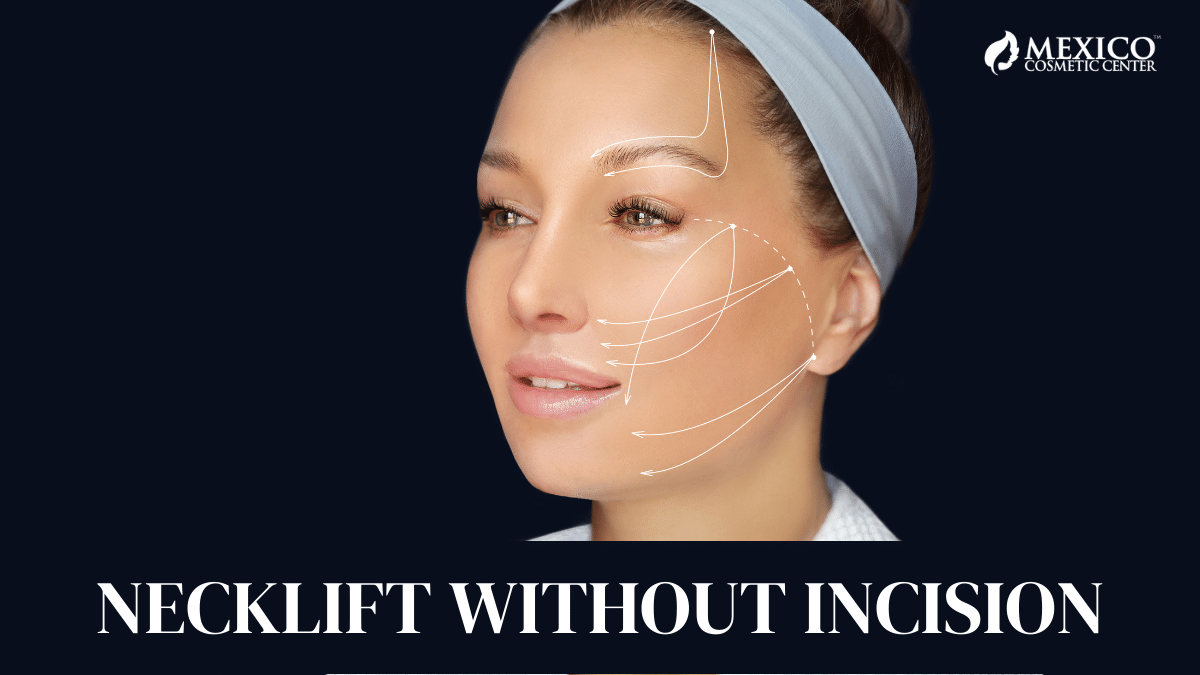 Cosmetic Necklift and Muscle Tightening Without an Incision