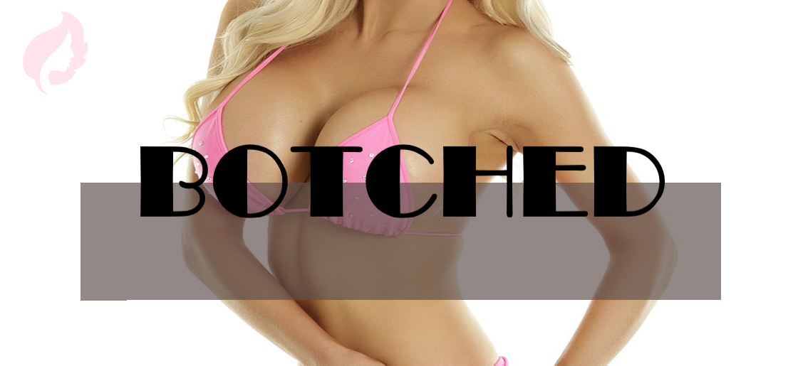Botched Plastic Surgery – Repair, Revise and Fix Surgery