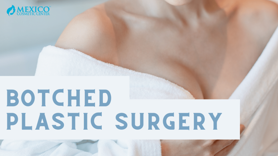 Botched Plastic Surgery – Repair, Revise and Fix Surgery