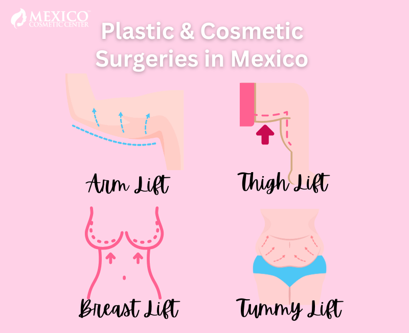 Plastic & Cosmetic Surgery in Mexico